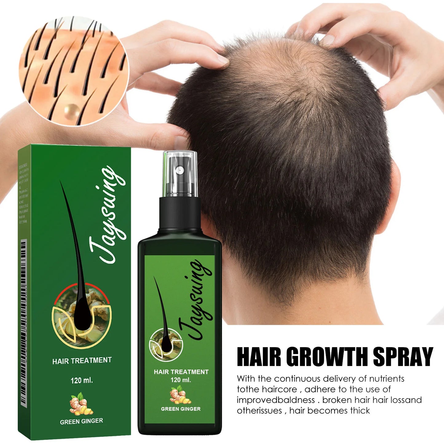 alalar-Hair Growth Spray Ginger Massage Scalp Damaged Treatmentalalar-بخاخ نمو الشعر، تدليك الزنجبيل، حل علاجي لفروة الرأس التالفة، تغذية الجذور، نمو سريع، مصل مضاد لتساقط الشعر، الجمال والصحة
