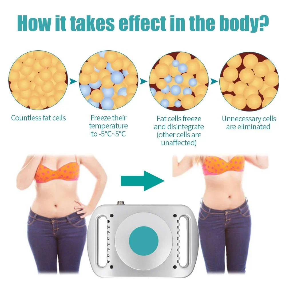 alala-Health-Beauty Fat Freezing Cryotherapy Slimming Machine Body Fat Burner -جهاز تنحيف الجسم، حزام تشكيل البطن، جهاز شفط الدهون بالتبريد لإزالة الدهون